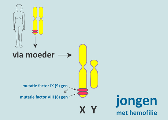 Hemofilie is een erfelijke aandoening, wat houdt dat in ...